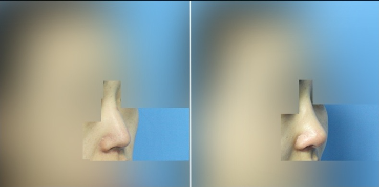 Slider image (4) MISOU Plastic Surgery